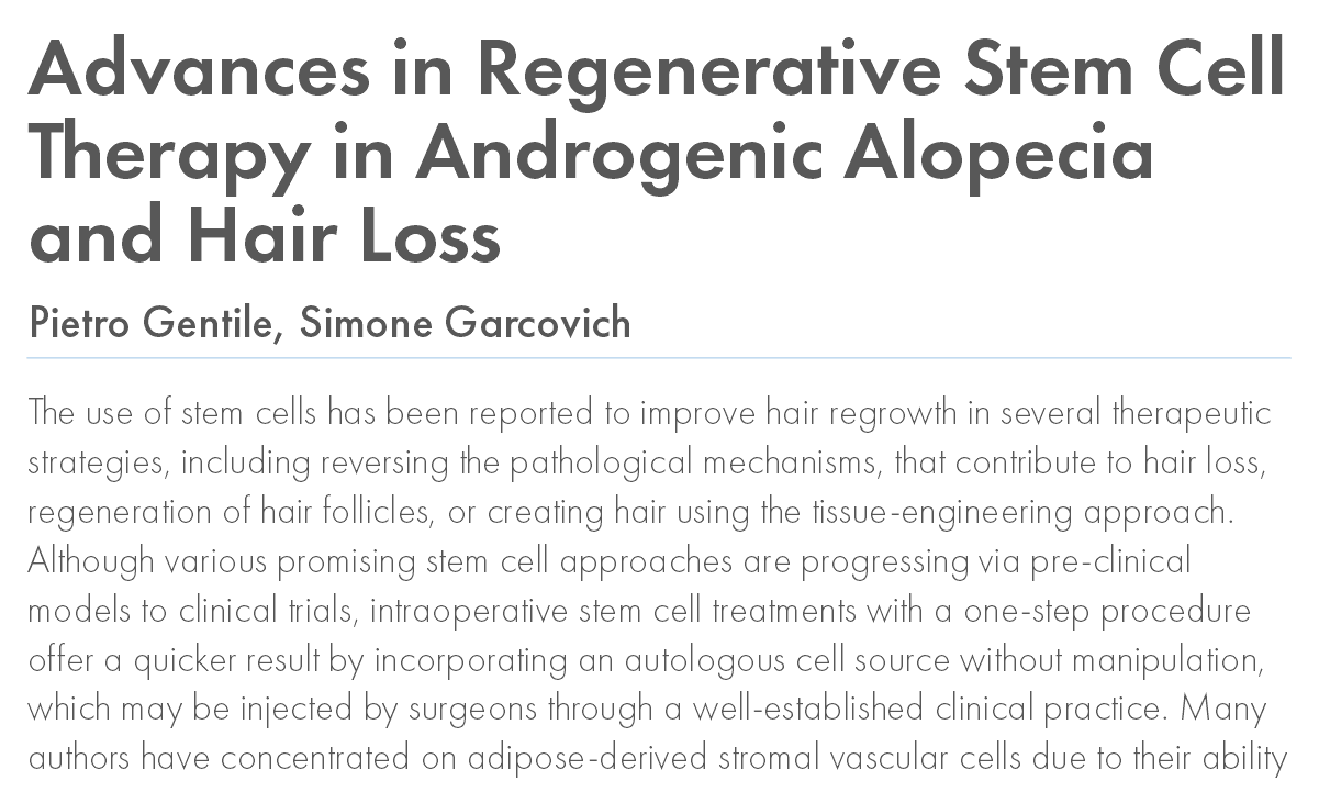 Advances in Regenerative Stem Cell Therapy in Androgenic Alopecia and Hair Loss